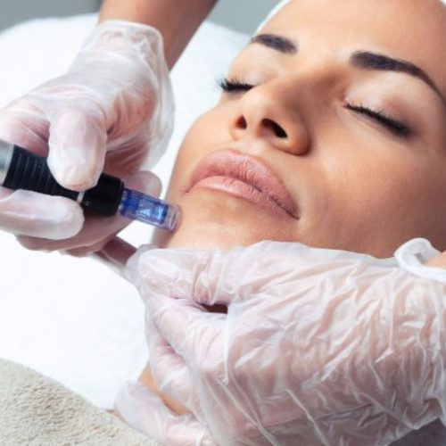 dermapen-1