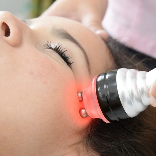 radiofrecuencia_facial